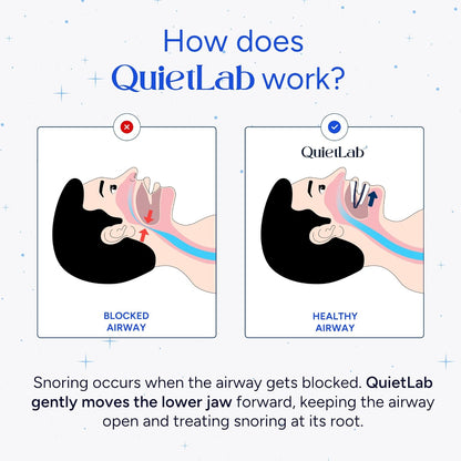 QuietLab Pro Anti-Snoring Mouthpiece - Adjustable Snoring Mouth Guard, Orthodontist Designed, No Boiling Required - BPA-Free Medical Grade - Designed for Nighttime Snoring Control
